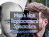 Hairskeen Men's Hair Replacement System in Dallas