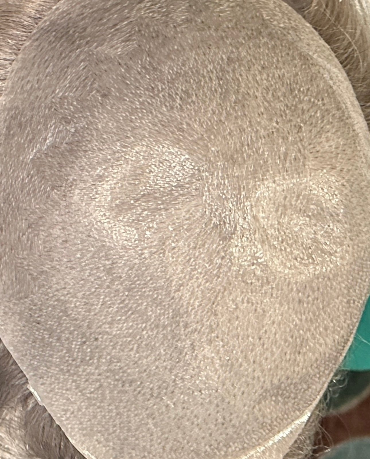 Hairskeen Men's Hair Replacement System in Dallas