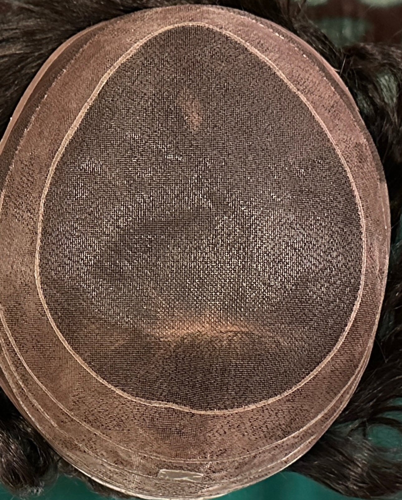 Hairskeen Men's Hair Replacement System in Dallas