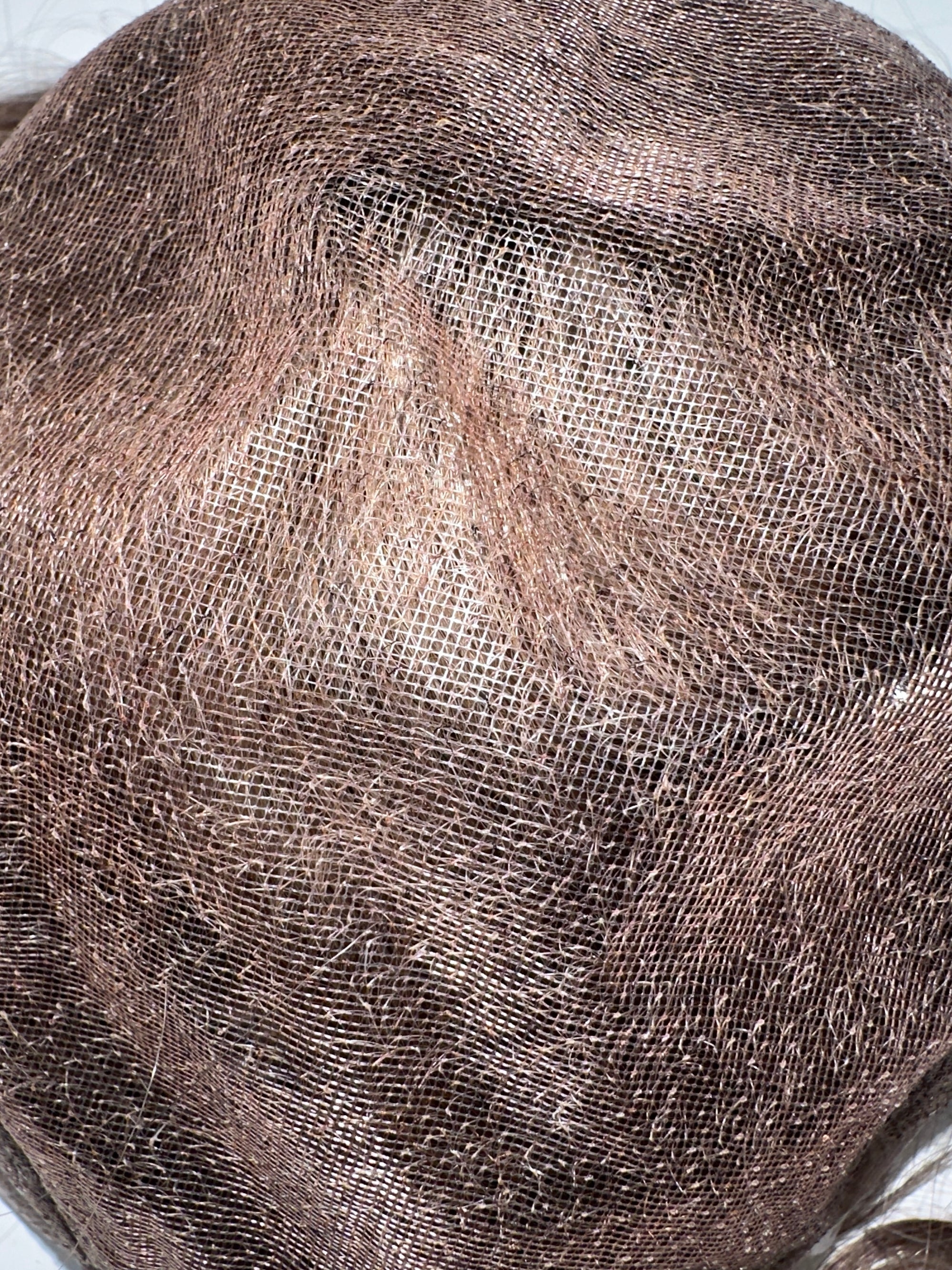 Hairskeen Men's Hair Replacement System in Dallas